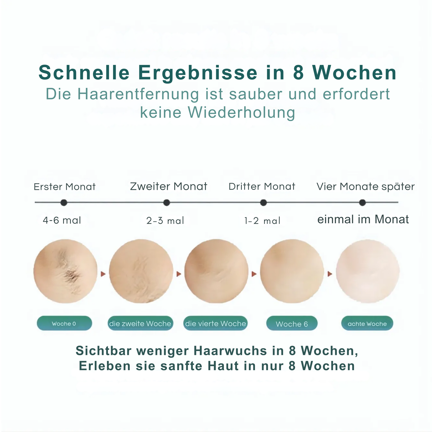 Tragbare 6-stufige Haarentfernung für Körper, Beine, Scham und Bikinizone für Frauen